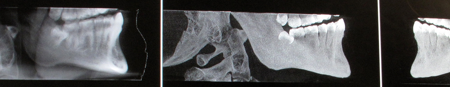 x-ray cover image